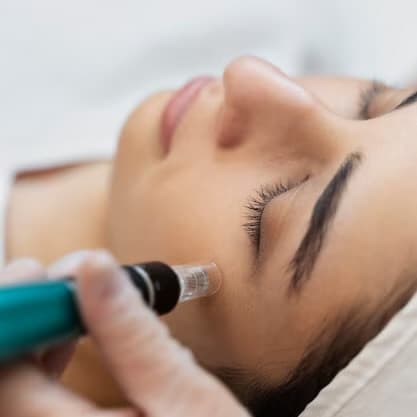Microneedling with exosomes at Olivia Esthetics in Longview, TX